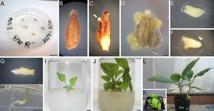 Cultivo de anteras de berenjena y obtención de dobles haploides.